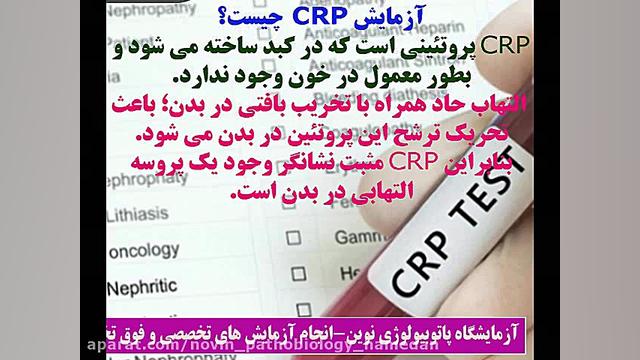 آزمایش CRP چیست؟ آزمایشگاه پاتوبیولوژی نوین همدان