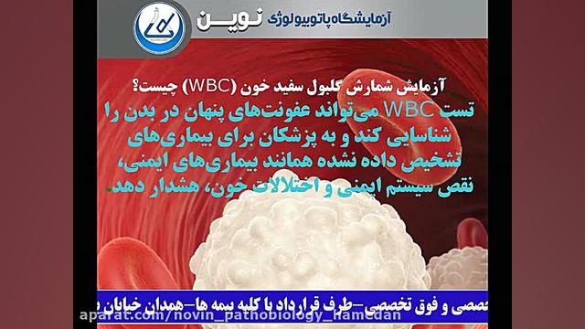 آزمایش شمارش گلبول سفید خون (WBC) چیست؟ آزمایشگاه پاتوبیولوژی نوین همدان