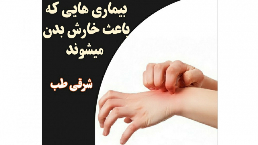 خارش بدن | خشکی پوست ترمیم زیبایی دندان