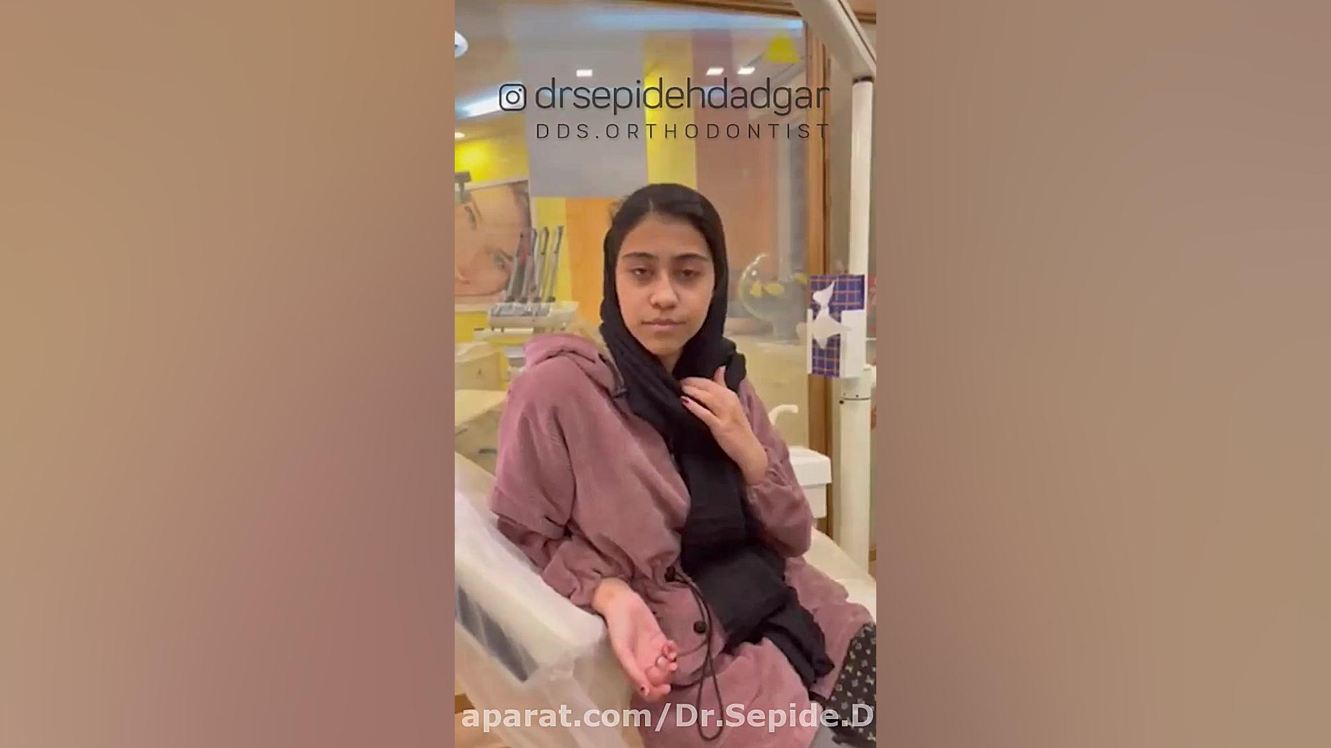 نظر یکی از بیماران که ارتودنسی همراه با جراحی فک داشته اند | دکتر سپیده دادگر قارچ‌شناسی پزشکی