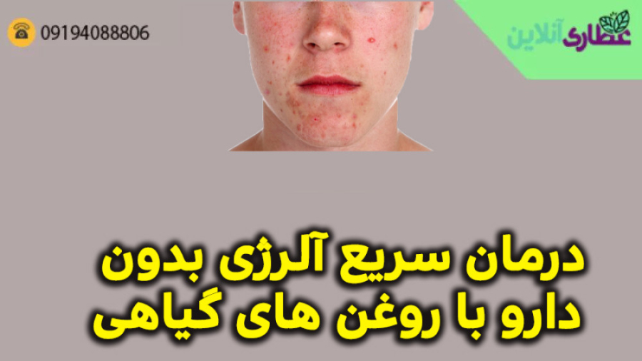 علت جوش‌ صورت چیست؟