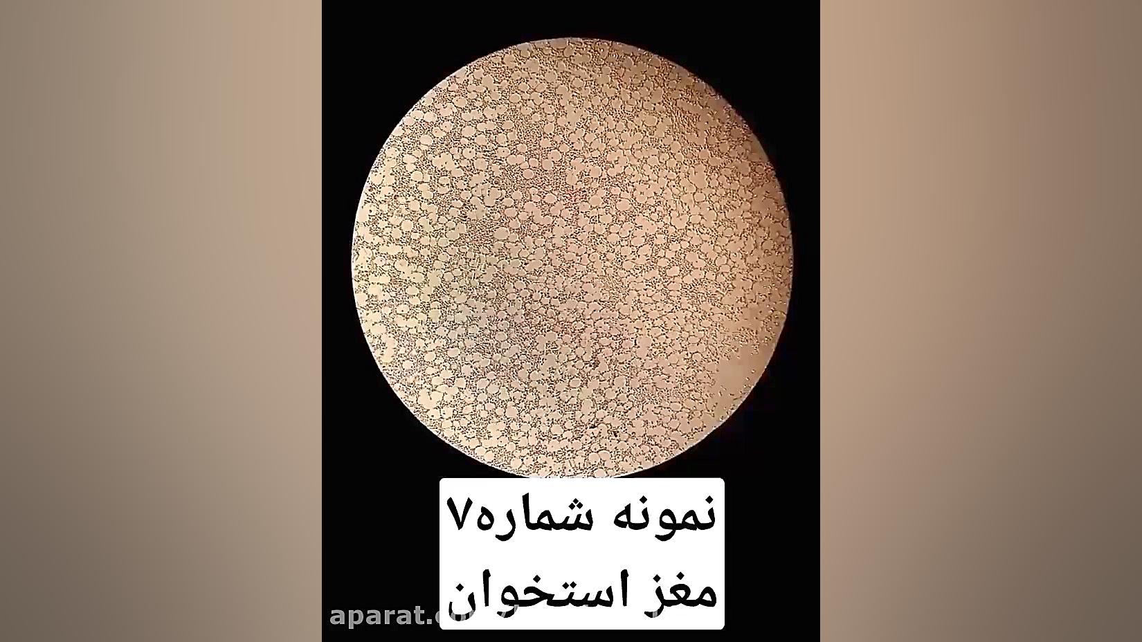 نمونه میکروسکوپی،مغز استخوان،دبیر آقای گودرزی کلینیک دندانپزشکی