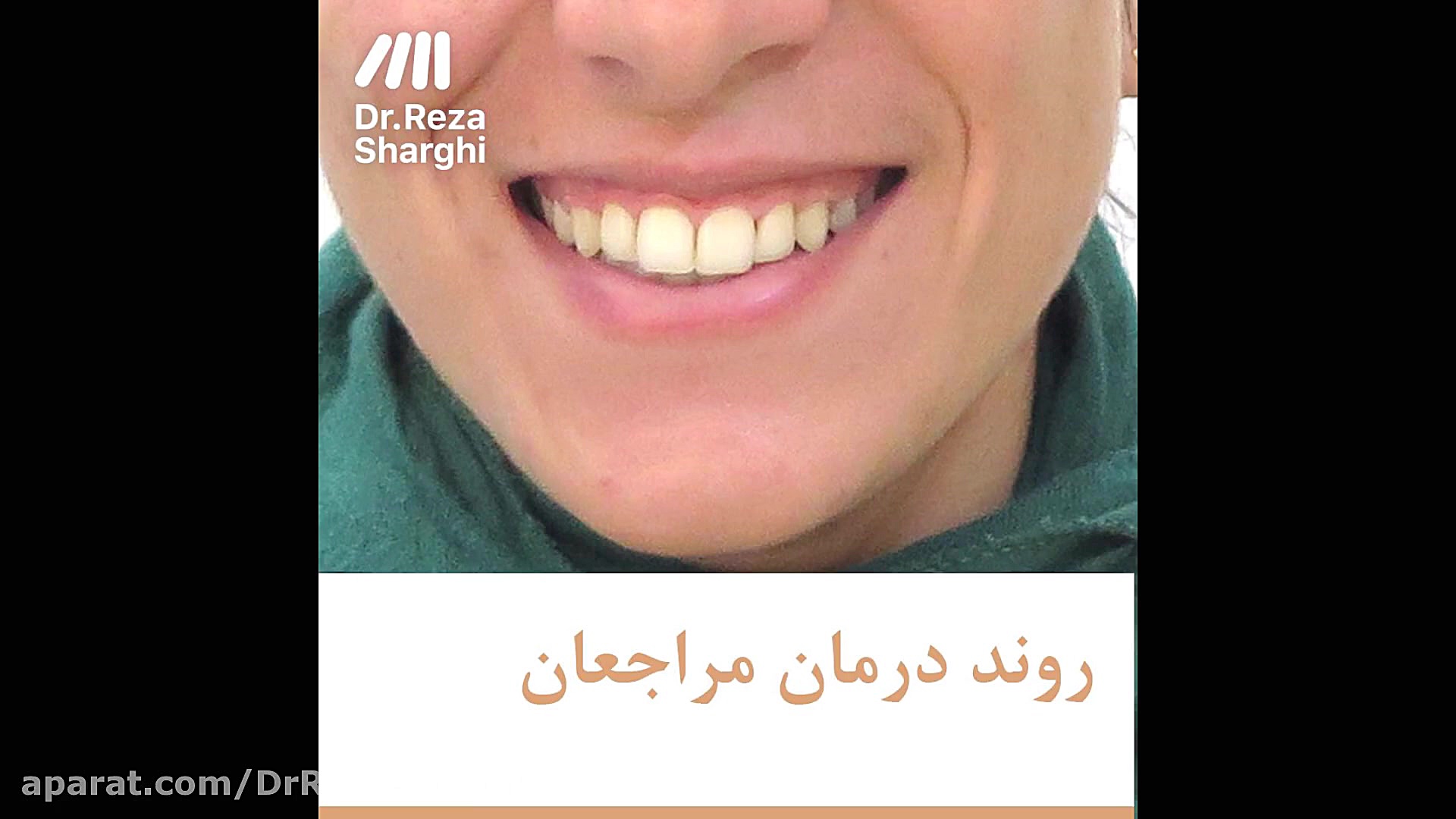 روند درمان ارتودنسی دکتر رضا شرقی