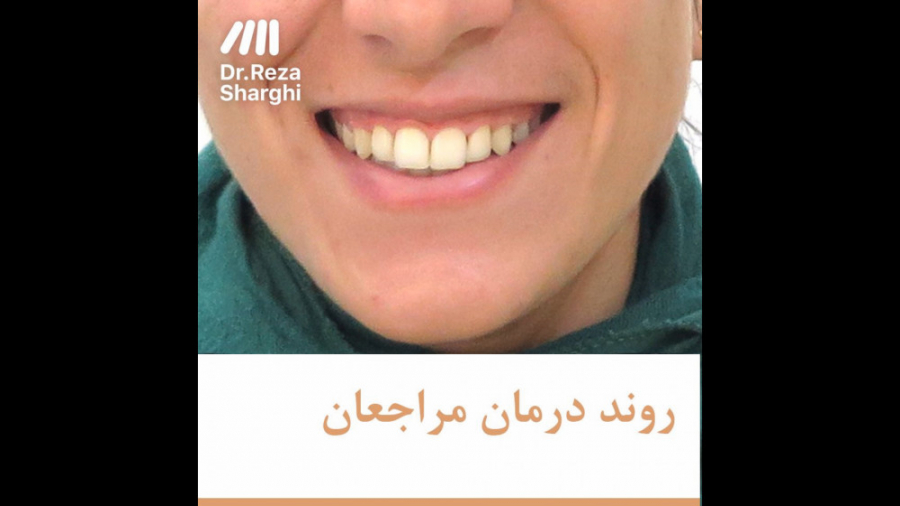 روند درمان ارتودنسی دکتر رضا شرقی