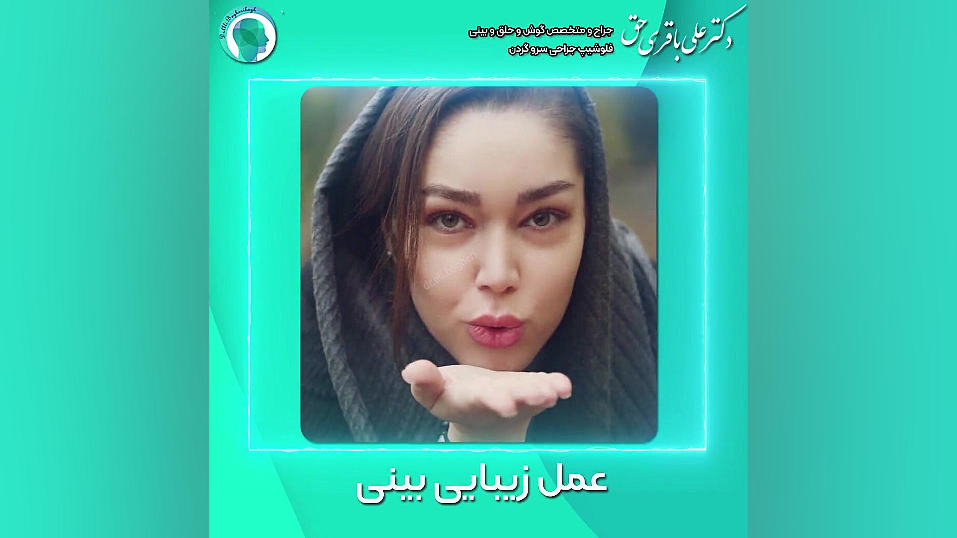 جراحی زیبایی بینی | دکتر علی باقری حق دکتر علی باقری حق