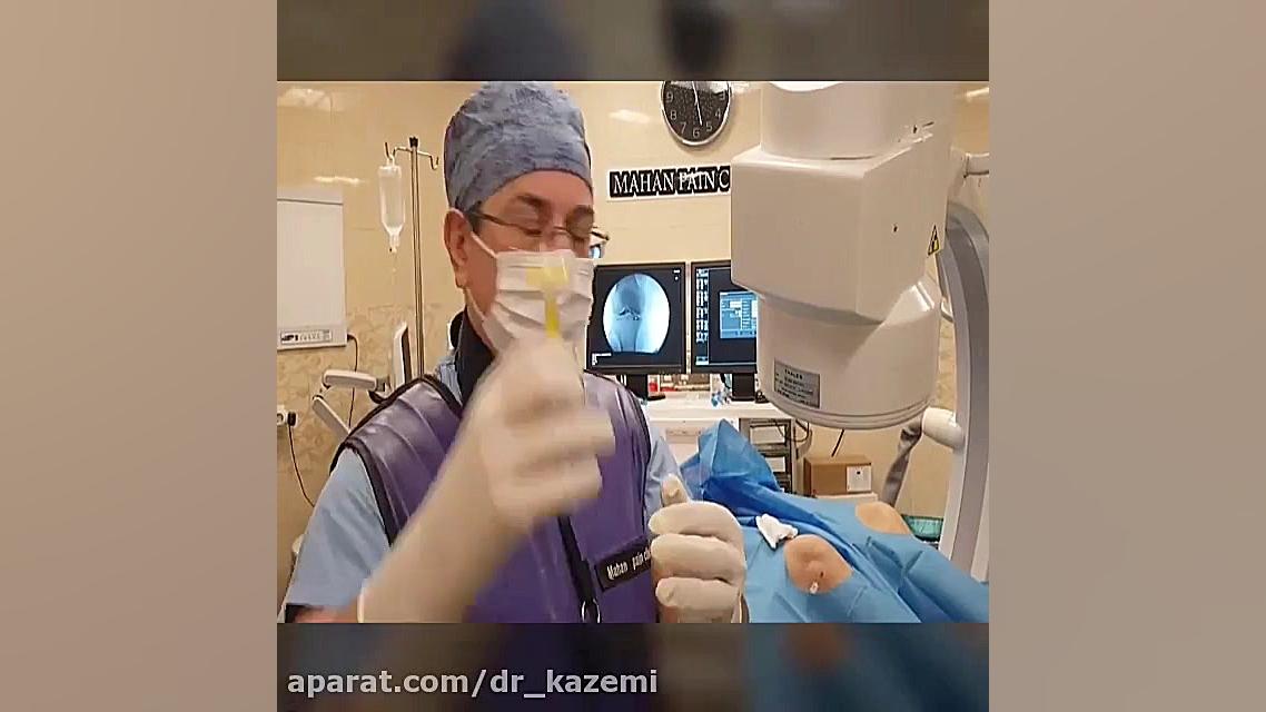 تزریق ارتوکین در زانو برای درمان آرتروز زانو کلینیک مو