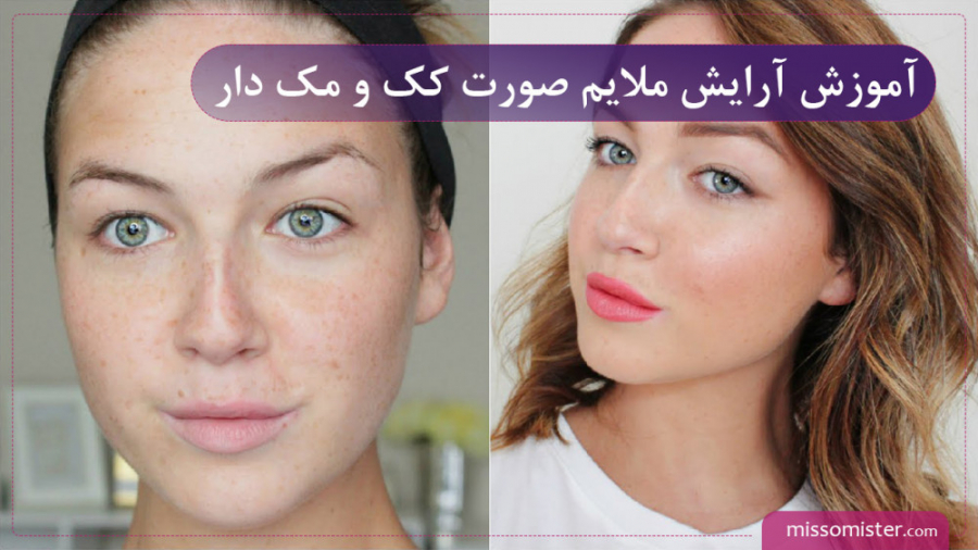 چگونه صورت کک و مک دار را آرایش کنیم؟