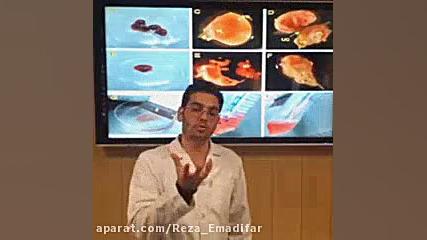 استخراج و کشت سلولهای جنین موش گرایش سلول های بنیادی هایفوتراپی