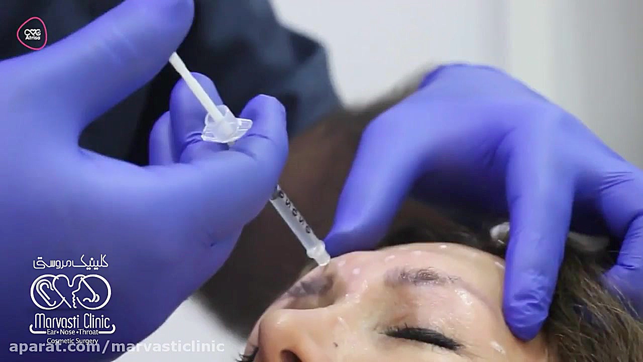 تزریق بوتاکس برای رفع چین و چروک رفع چین و چروک