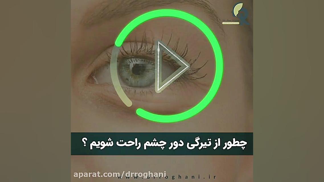 چطور از تیرگی دور چشم خلاص شویم؟ دکتر ایمان روغنی جراح و متخصص پوست و مو