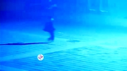 شکستگی لگن کودک ۶ ساله پس از انداختن ترقه در چاه