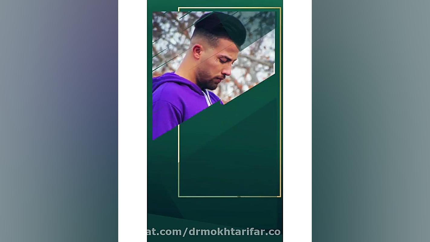 حدود یک سال پس از جراحی زیبایی در بینی گوشتی با کمبود بافت و ضعف غضروفی شدید دکتر فاطمه مختاری فر جراح بینی در لرستان