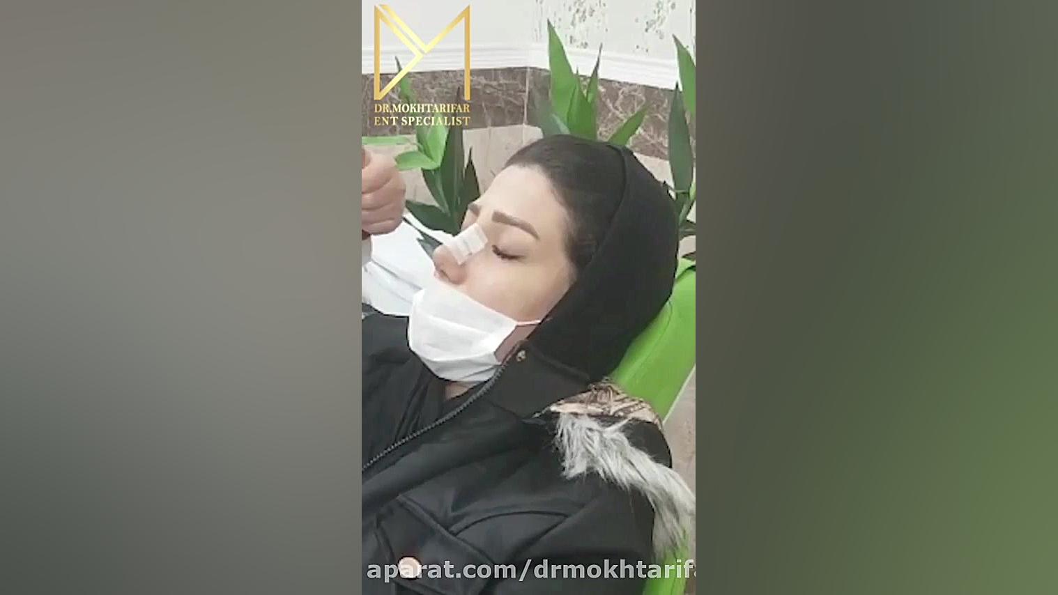 طریقه چسب زدن بینی پس از انجام جراحی زیبایی دکتر فاطمه مختاری فر جراح بینی در لرستان