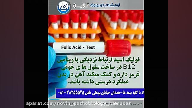 آزمایش اندازه گیری فولیک اسید(B9) آزمایشگاه پاتوبیولوژی نوین همدان