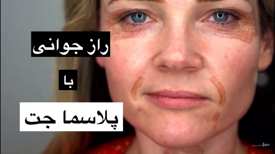 آموزش کار با دستگاه پلاسما جت