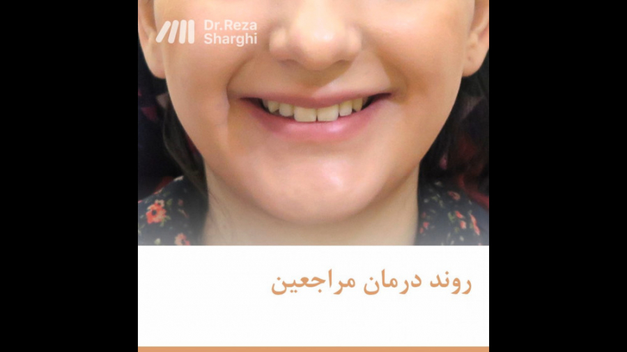 روند درمان ارتودنسی دکتر رضا شرقی