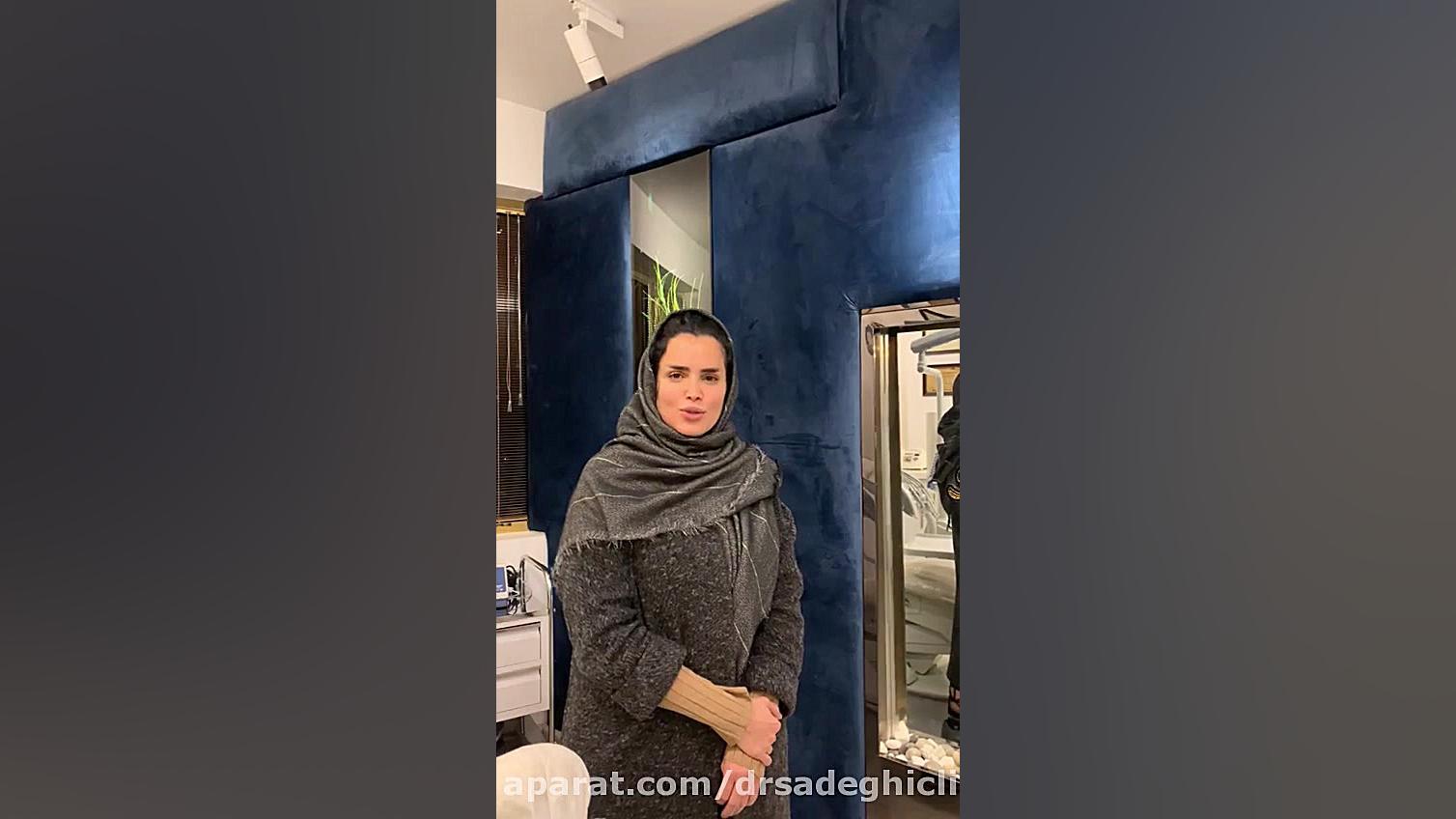 کامپوزیت ونیر در تهران | تخفیف کامپوزیت ونیر در شمال تهران برداشتن خال