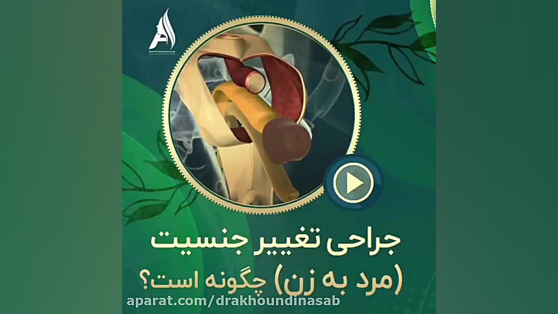 جراحی تغییر جنسیت (مرد به زن)به صورت شماتیک دکتر محمدرضا آخوندی نسب-فوق تخصص جراحی پلاستیک