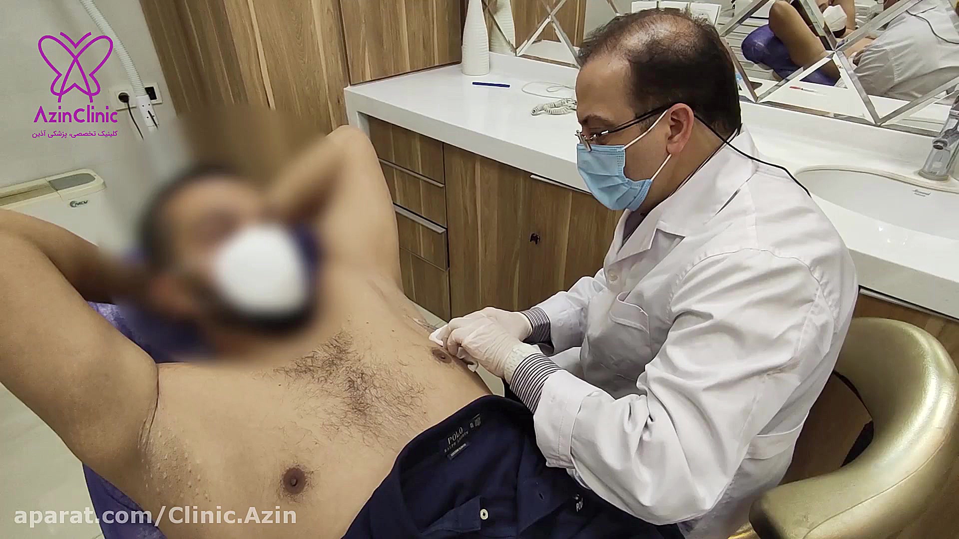 تزریق بوتاکس زیربغل برای جلوگیری از تعریق زاویه سازی صورت