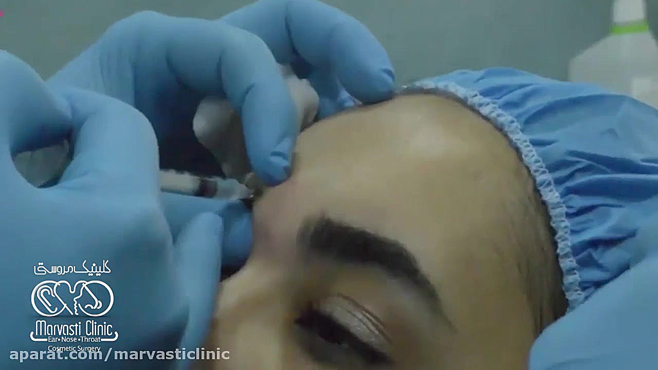 تزریق بوتاکس و حذف چین و چروک کامپوزیت ونیر