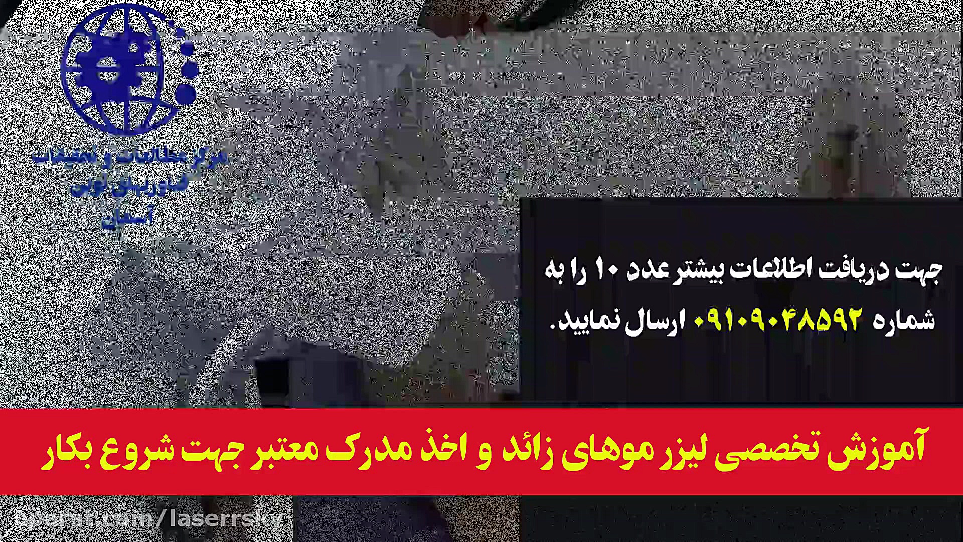 اموزش لیزر موهای زائد پرمترکسد