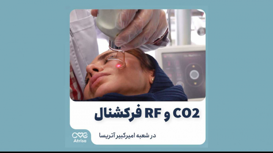 لیزر co2 فرکشنال پرویز پرستویی