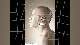 جیپسی کینگز ، الکس یا محسن چاوشی؟! جراحی لثه