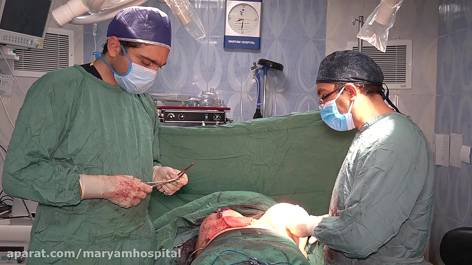 ماموپلاستی ترلتینیب