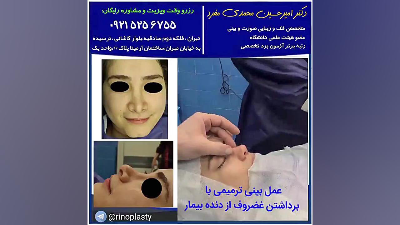 عمل ترمیمی بینی دکتر امیرحسین محمدی مفرد دکتر امیر حسین محمدی مفرد