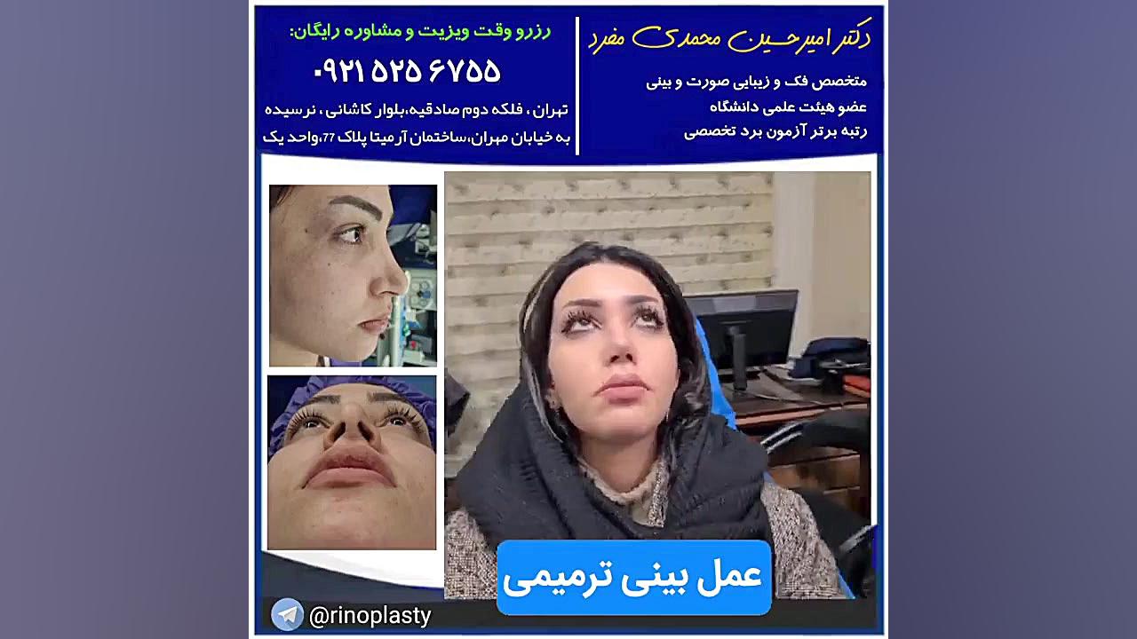 عمل ترمیمی بینی ، دکتر امیرحسین محمدی مفرد دکتر امیر حسین محمدی مفرد
