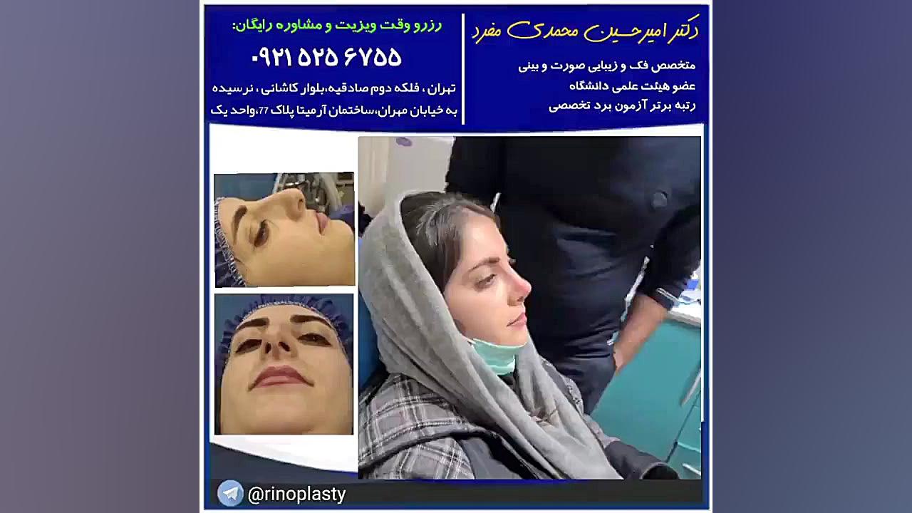 عمل زیبایی بینی ، دکتر امیرحسین محمدی مفرد 09215256755 دکتر امیر حسین محمدی مفرد