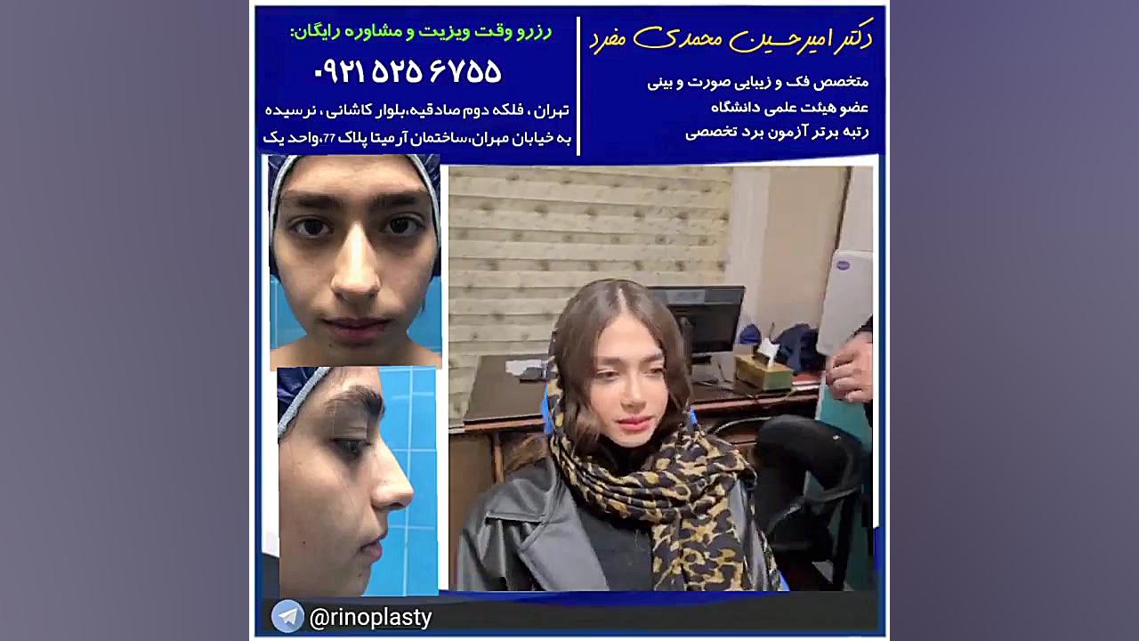 عمل زیبایی بینی ، دکتر امیرحسین محمدی مفرد 09215256755 دکتر امیر حسین محمدی مفرد