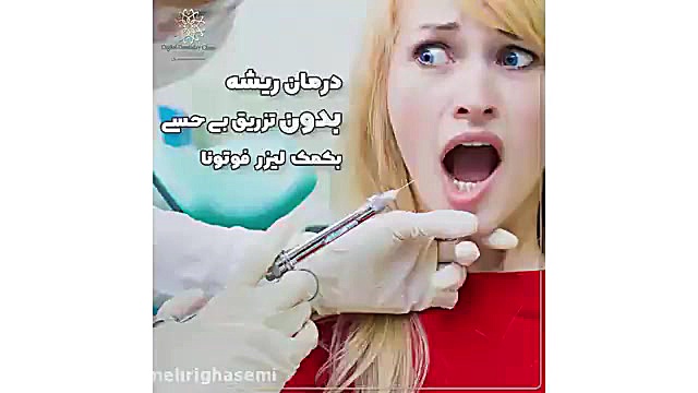 یکی از عملکردهای دستگاه لیزر فوتونا | کلینیک دندانپزشکی دیجیتال دکتر مهری قاسمی مرکز دندانپزشکی دیجیتال دکتر مهری قاسمی