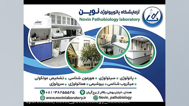 آزمایش ( PT/INR) چیست ؟ آزمایشگاه پاتوبیولوژی نوین همدان