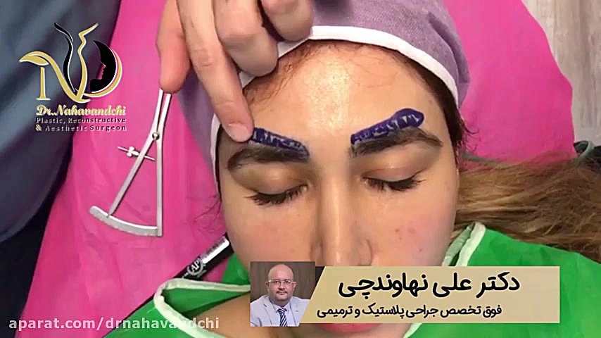 فیلم جراحی لیفت ابرو از نزدیک ان트ريكتینیب