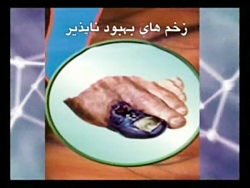 دیابت بیماری قند