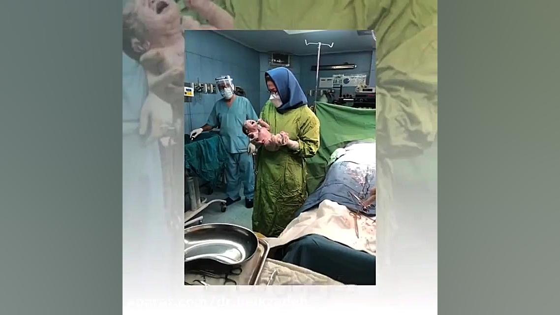 زایمان سزارین توسط خانم دکتر بیک زاده دکتر مژگان بیک زاده ( جراح و متخصص زنان و زایمان)