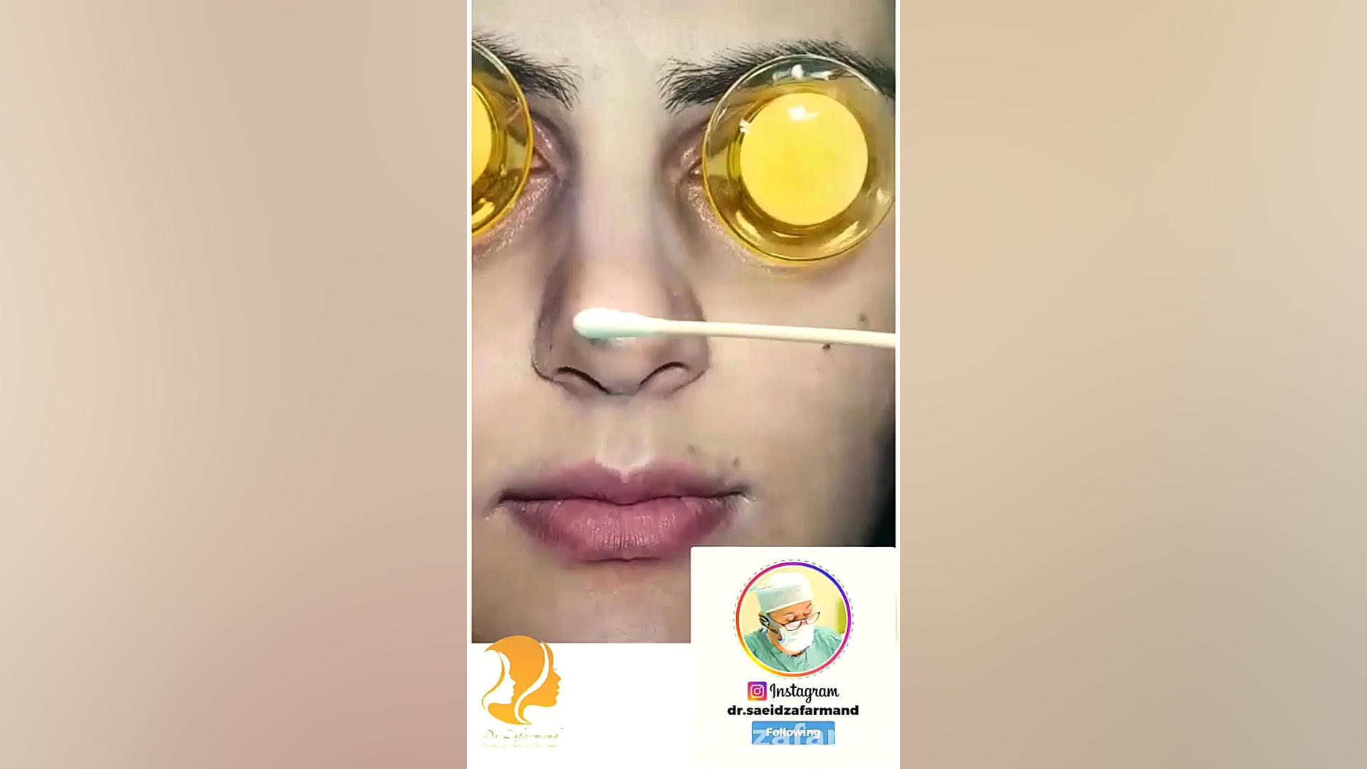 جراحی زیبایی بینی در اتاق عمل کلینیک دندانپزشکی