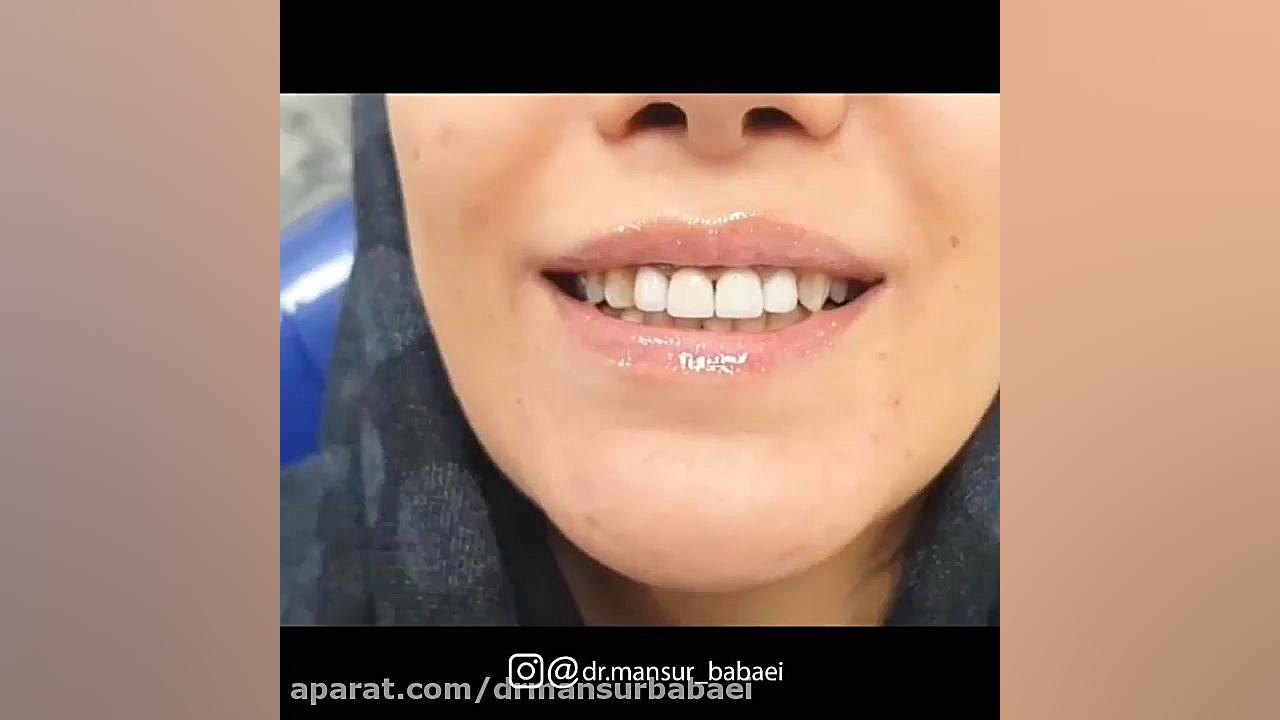 لبخند درخشان دکتر منصور بابایی
