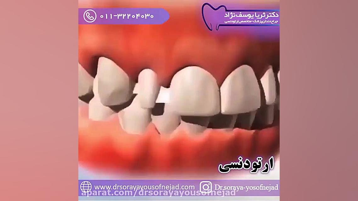 ارتودنسی دکتر ثریا یوسف نژاد متخصص ارتودنسی بابل