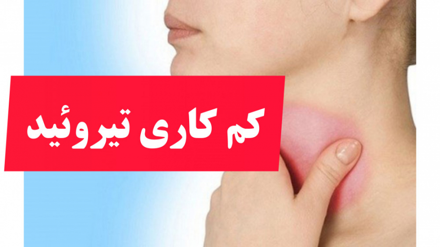 درمان کم کاری تیروئید جراحی لثه
