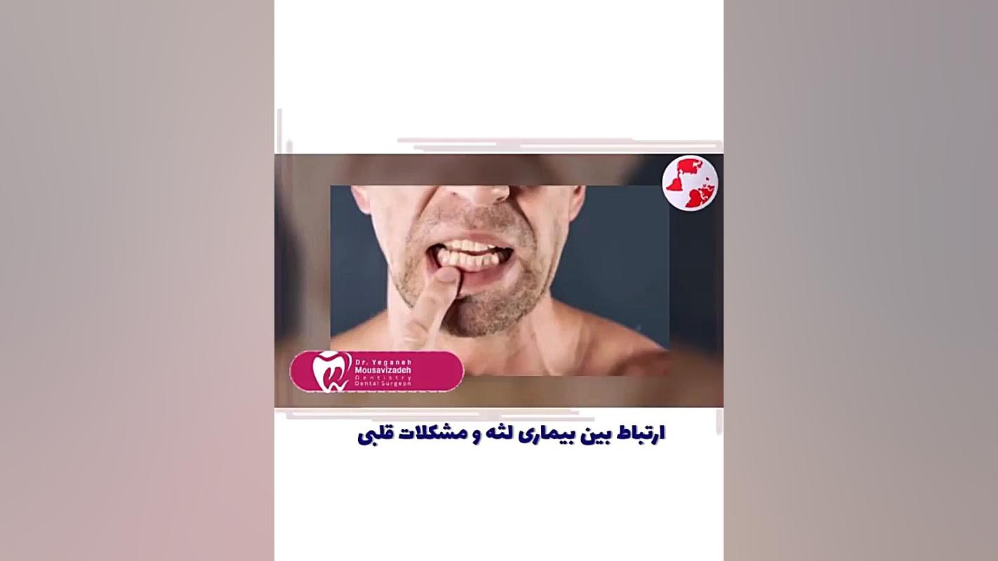 ارتباط بین بیماری لثه و مشکلات قلبی ارنیزوماب