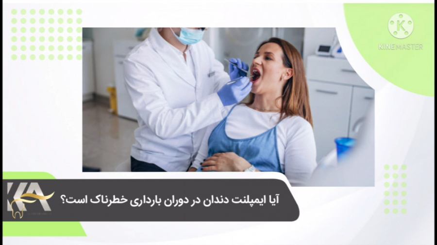 آیا انجام فرایند ایمپلنت دندان در دوره بارداری ضرورت دارد؟ دکتر کامیار عباسی