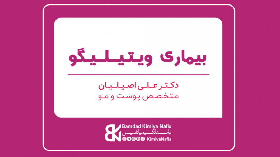 بیماری ویتیلیگو دکتر علی اصیلیان کمند امیرسلیمانی