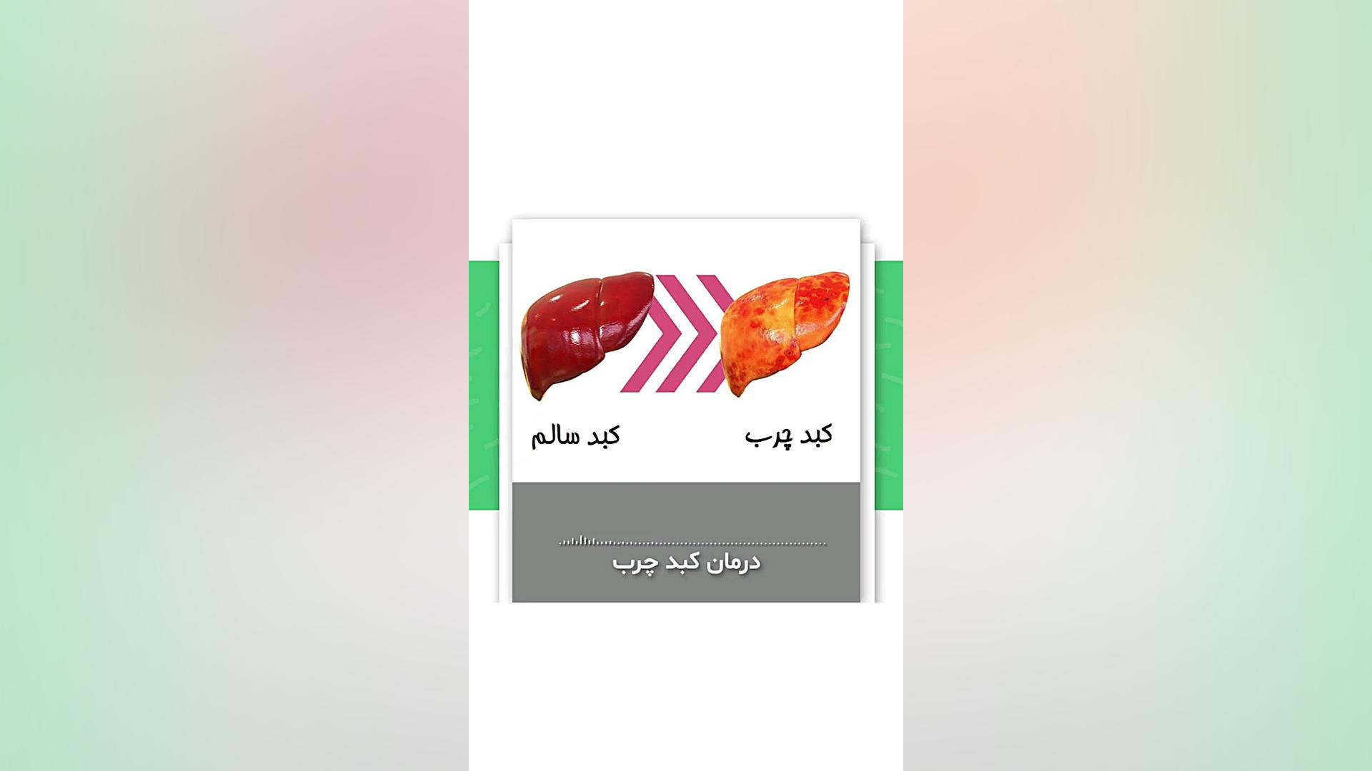 صحبت های دکتر طاهری درباره کبد چرب (پارت اول) زاویه سازی صورت