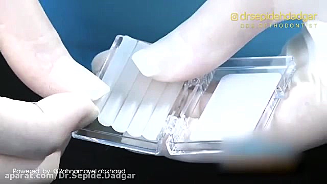 استفاده از موم ارتودنسی | دکتر سپیده دادگر برداشتن زگیل