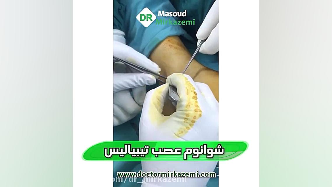 فیلم پیوند عصب احسان خواجه‌امیری