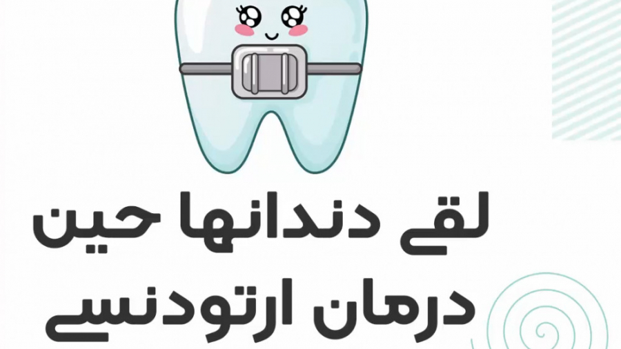لقی دندانها حین درمان ارتودنسی دکتر سعید فروغی متخصص ارتودنسی