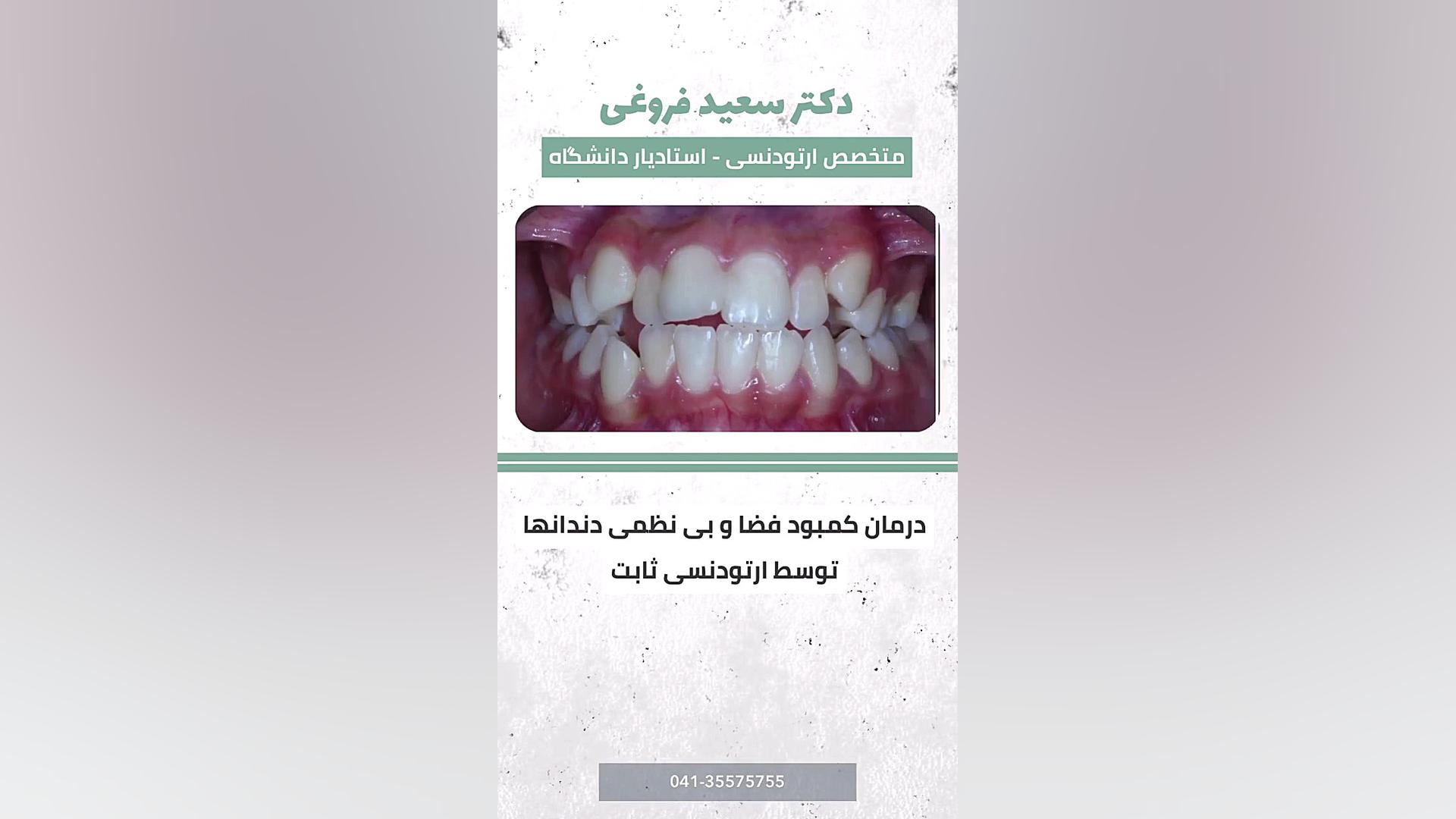 ارتودنسی دندان دکتر سعید فروغی متخصص ارتودنسی