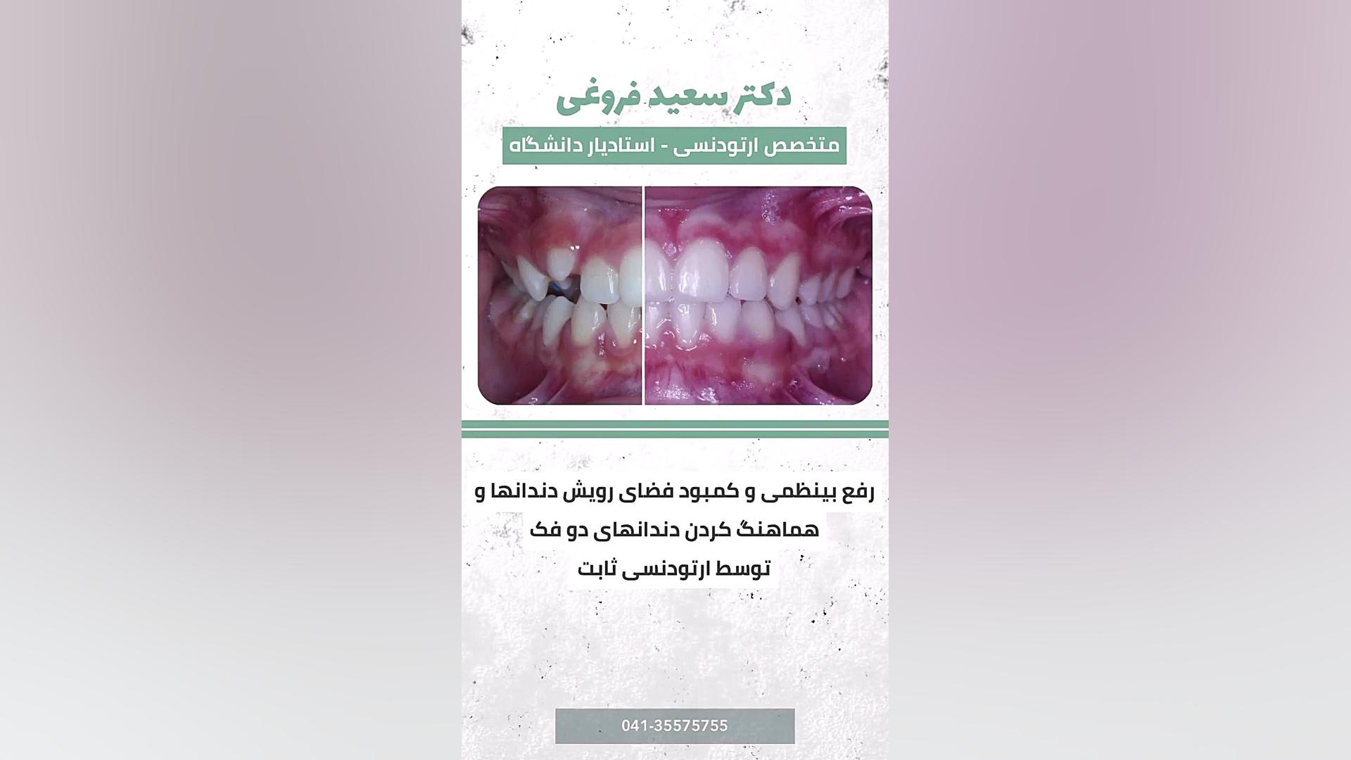 ارتودنسی دندان دکتر سعید فروغی متخصص ارتودنسی